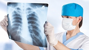 TÜBERKÜLOZ, DÜNYADAKİ DOKUZUNCU ÖLÜM SEBEBİ