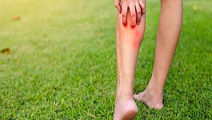 Böcek Sokmalarına Karşı İlk Yapılması Gerekenler