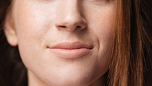 Burun Botoksu İle Hareketli Deliklere Son!