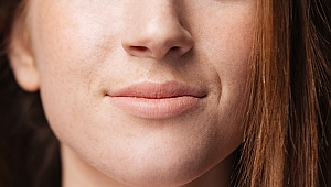 Burun Botoksu İle Hareketli Deliklere Son!