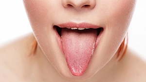 DİL KANSERİNİN 5 ÖNEMLİ BELİRTİSİ!