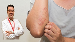 Egzamadan Korunmak İçin 12 Önlem