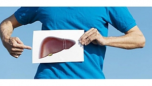 Karaciğerinizdeki Sinsi Hastalık: NASH