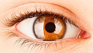 Korneal dövme ile hayata yeniden merhaba dedi