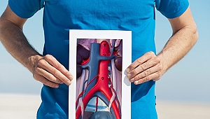 Vücudun Gizli Tehlikesi Aort Anevrizması