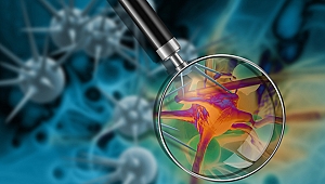 HÜCRESEL DEĞİŞİMLERE GÖRE TEDAVİ FARKLILAŞIYOR!