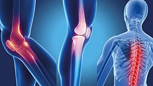 Romatizma Artık Gençleri de Etkiliyor