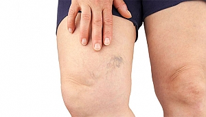 VARİSLERİNİZDEN MODERN YÖNTEMLERLE KURTULUN