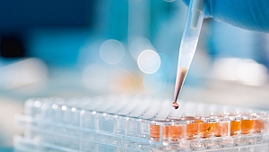 ExxonMobil’in Bir Milyonu Aşkın Kullanılmış Yağ Analizi