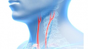ŞAH DAMAR TIKANIKLIĞINA DİKKAT