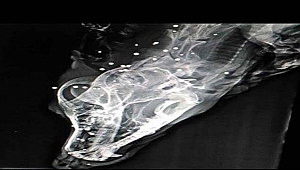 Sokak köpeği vücudundaki 126 saçmayla yaşıyor