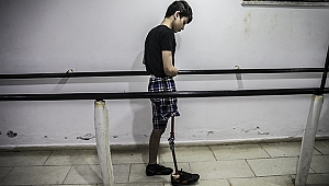 Savaş Mağduru Çocukların Protez Mutluluğu
