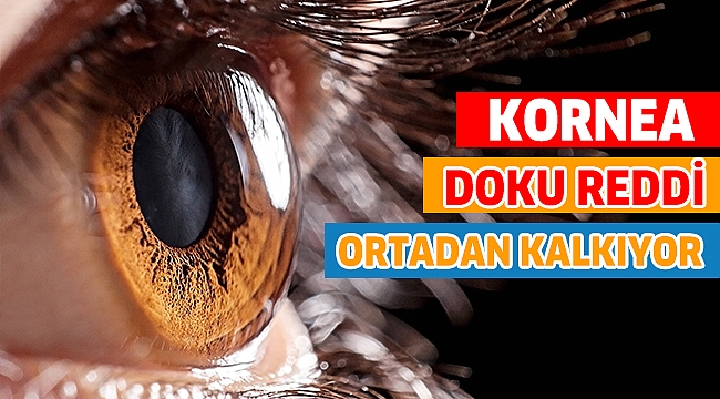 KORNEA NAKLİNDE DOKU REDDİ ORTADAN KALKIYOR
