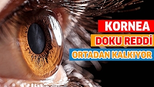 KORNEA NAKLİNDE DOKU REDDİ ORTADAN KALKIYOR