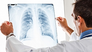 SİGARA İÇENLERDE RİSK ARTIYOR