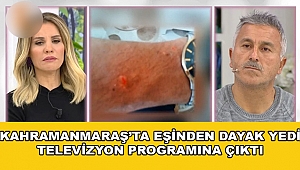 KAHRAMANMARAŞTA EŞİNDEN DAYAK YEDİ TELEVİZYON PROGRAMINA ÇIKTI