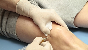 KÖK HÜCRE TEDAVİSİ KİREÇLEME TEDAVİSİNE UMUT