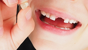 SÜT DİŞLERİNİN ZAMANINA DİKKAT