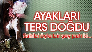 Ayakları ters doğdu