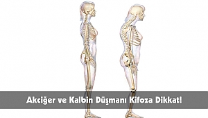 Akciğer ve Kalbin Düşmanı Kifoza Dikkat!
