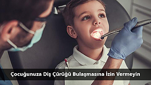 Çocuğunuza Diş Çürüğü Bulaşmasına İzin Vermeyin