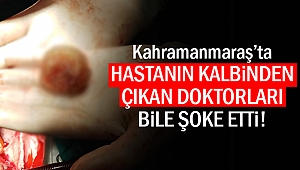 Kahramanmaraş'ta hastanın kalbinden çıkan doktorları şoke etti!