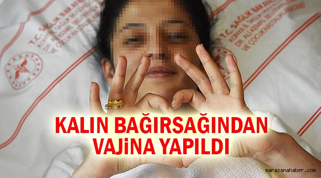 Kalın bağırsağından vajina yapıldı