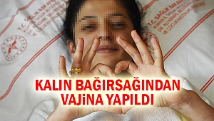 Kalın bağırsağından vajina yapıldı