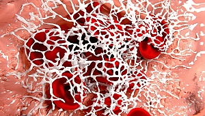 Hemofili hastalığının anne karnında teşhisi mümkün