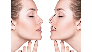 Cerrahın Sanatı 3 Boyutlu Burun Estetiği