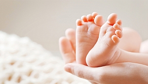 HER 1.000 BEBEKTEN BİRİ “ÇARPIK AYAK” SORUNUYLA DOĞUYOR