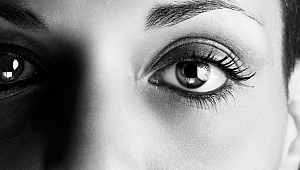 İRİ GÖZLER TİROİT HASTALIĞI HABERCİSİ OLABİLİYOR!