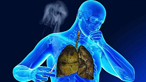 KOAH görülme sıklığı kadınlarda artıyor