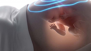 Hamilelik döneminde diş röntgeni tehlikeli mi?