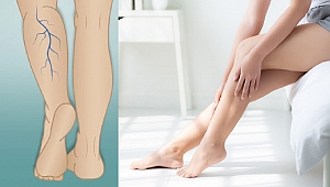 Varis Hakkında Doğru Bilinen Yanlışlar