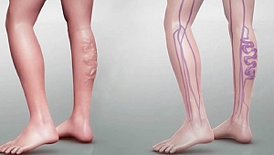 Varise Karşı Alınacak Önlemler