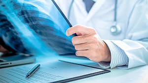 Akciğer Kanserinin 5 Önemli Belirtisi