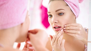 Akneye karşı 6 etkili öneri