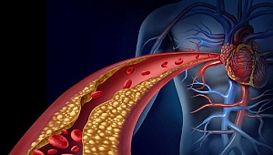 Damar Hastalıklarına Erken Müdahale: Damar Check-Up’ı