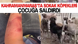 Kahramanmaraş’ta Sokak Köpekleri Çocuğa Saldırdı