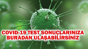 Covıd-19 Test Sonuçlarınıza Buradan Ulaşabilirsiniz