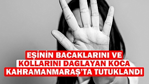 Eşinin Bacaklarını ve Kollarını Dağlayan Koca Kahramanmaraş’ta Tutuklandı