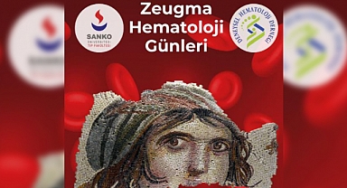 Gaziantep Zeugma Hematoloji Günleri