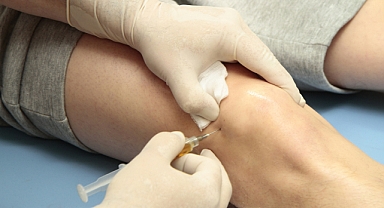 Diz kireçlenmesi için kök hücre tedavisi gündemde