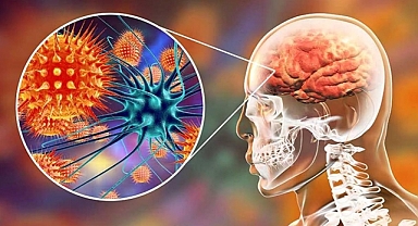 Aşıyla önlenebilen tehlikeli bir hastalık: Menenjit