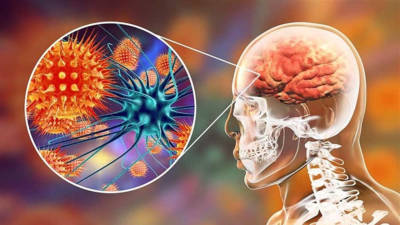 Aşıyla önlenebilen tehlikeli bir hastalık: Menenjit