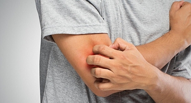 Mantar hastalığı hakkında bilinmesi gereken 6 önemli bilgi!