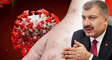 Eris varyantı Türkiye'de