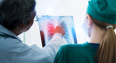 Akciğer kanseri sessizce ilerliyor, erken tanı çoğu zaman tesadüfen konuyor!