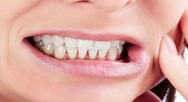 Soğuk içecekler dişlerinizi neden sızlatır?